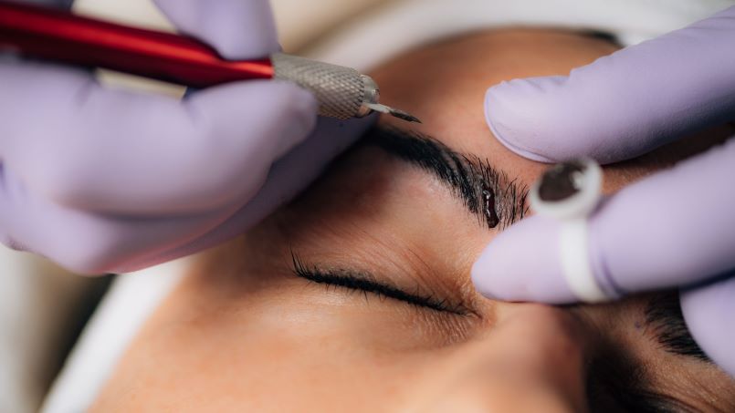 روش انجام فیبروز ابرو