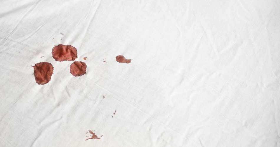 پاک کردن لکه خون