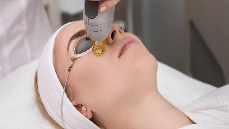 نحوه برطرف کردن لکه قهوه ای صورت